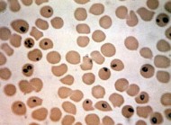 عَدْوى البابيزيا .. عَدُو الخيل – الجزء الأول