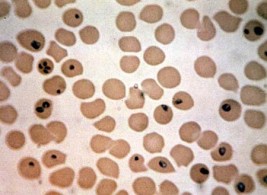 عَدْوى البابيزيا .. عَدُو الخيل – الجزء الأول