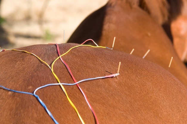 الوخز بالإبر